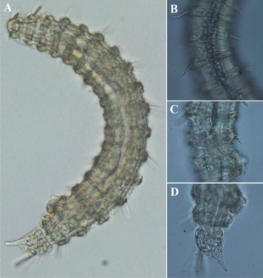 Desmoscolex n. sp. 14, DIC photomicrographs, male, lateral view