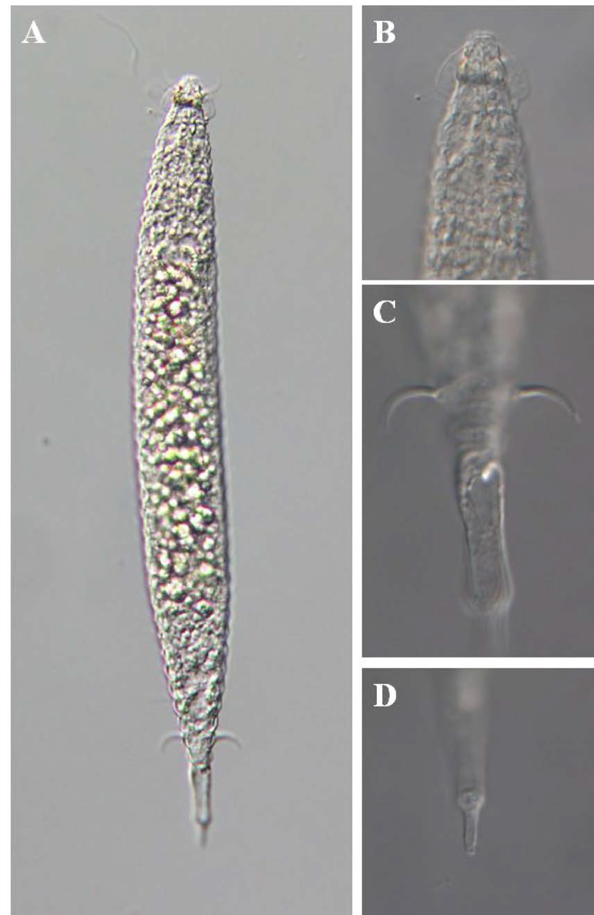 Protricomoides n. sp. 1, DIC photomicrographs, female