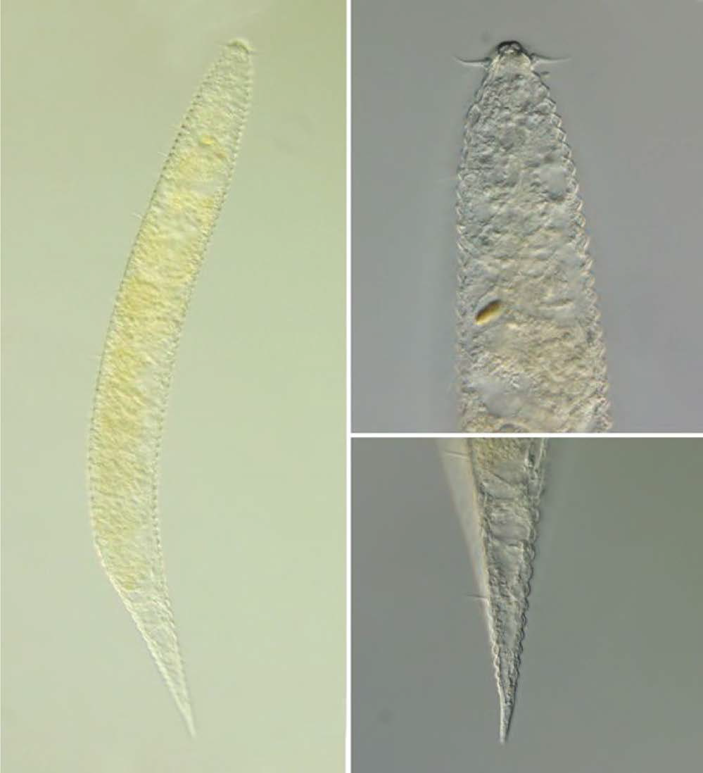 Protricomoides n. sp. 3, DIC photomicrographs, female, lateral view
