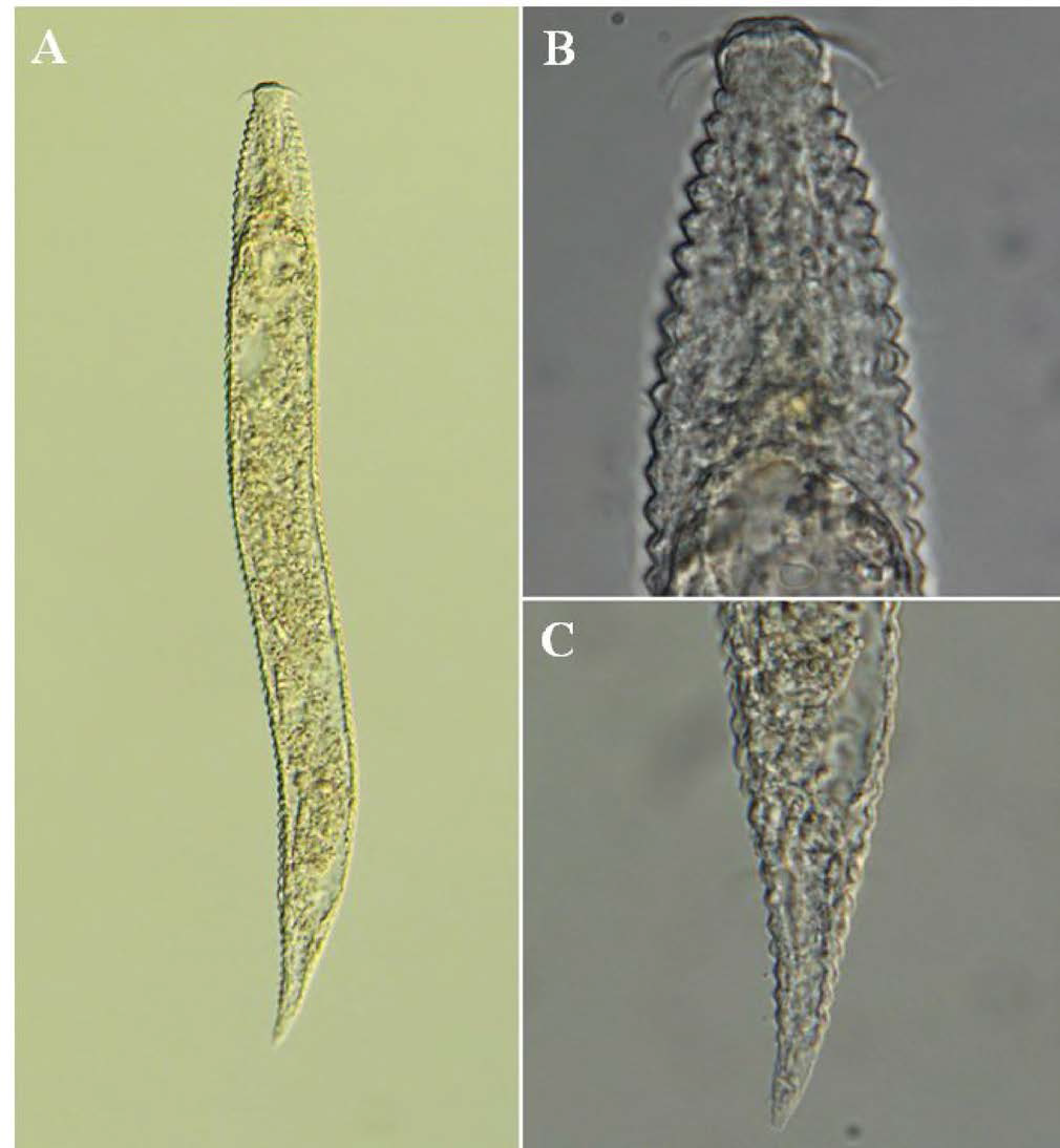 Protricomoides n. sp. 4, DIC photomicrographs, female, lateral view