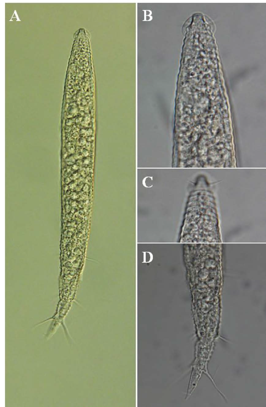 Protricomoides n. sp. 5, DIC photomicrographs, female, lateral view