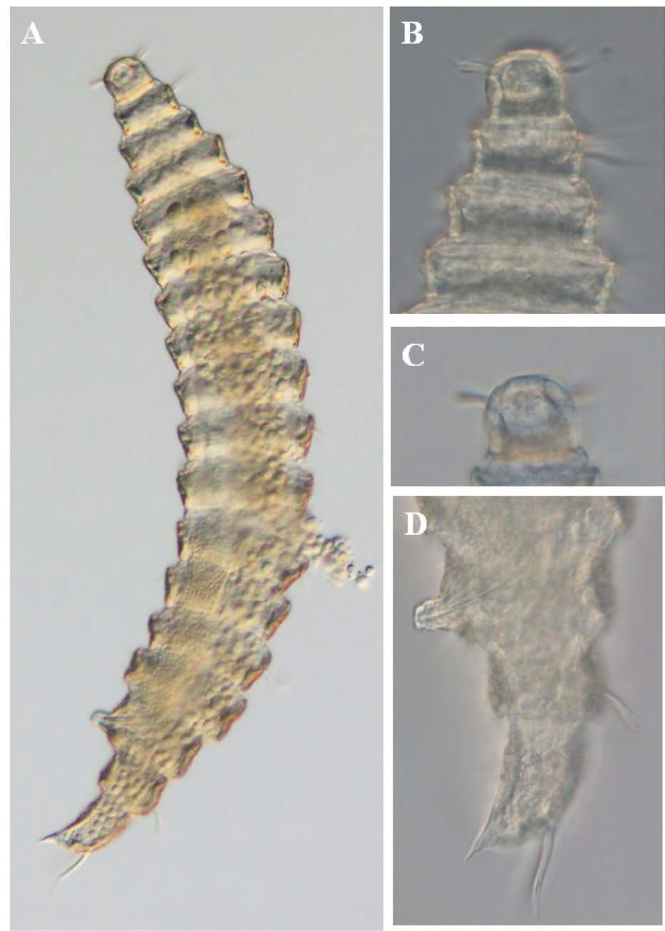 Desmolorenzenia n. sp. 1, DIC photomicrographs, male, lateral view