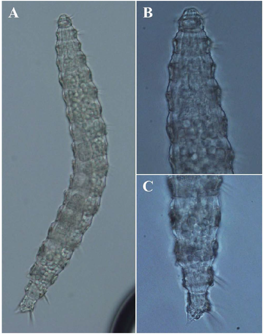 Desmoloremenia n. sp. 4, DIC photomicrographs, female, lateral view