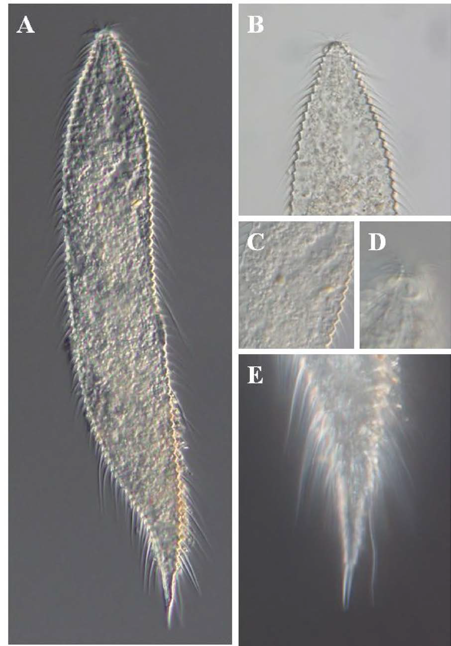 Greeffiella n. sp., DIC photomicrographs, female, lateral view