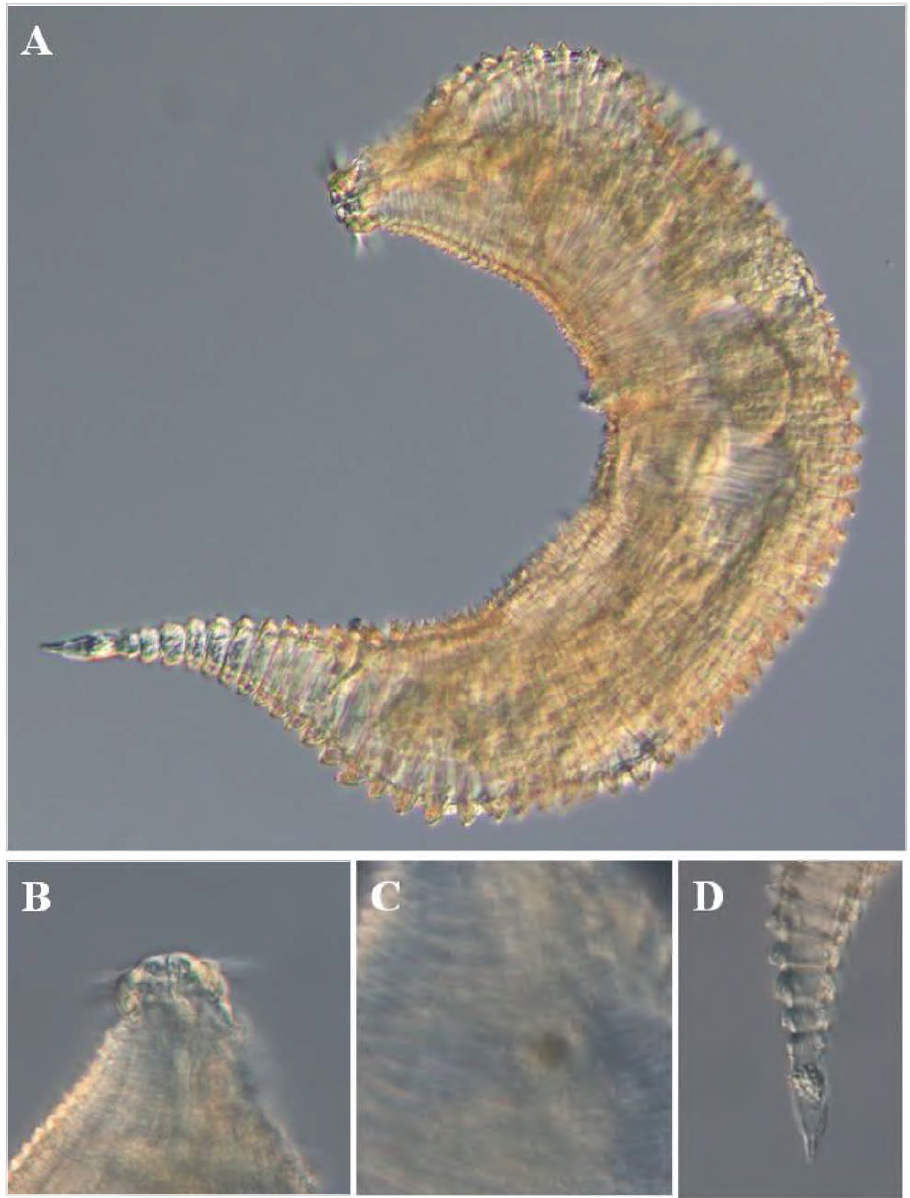 Quadricoma n. sp. 2, DIC photomicrographs, female, lateral view