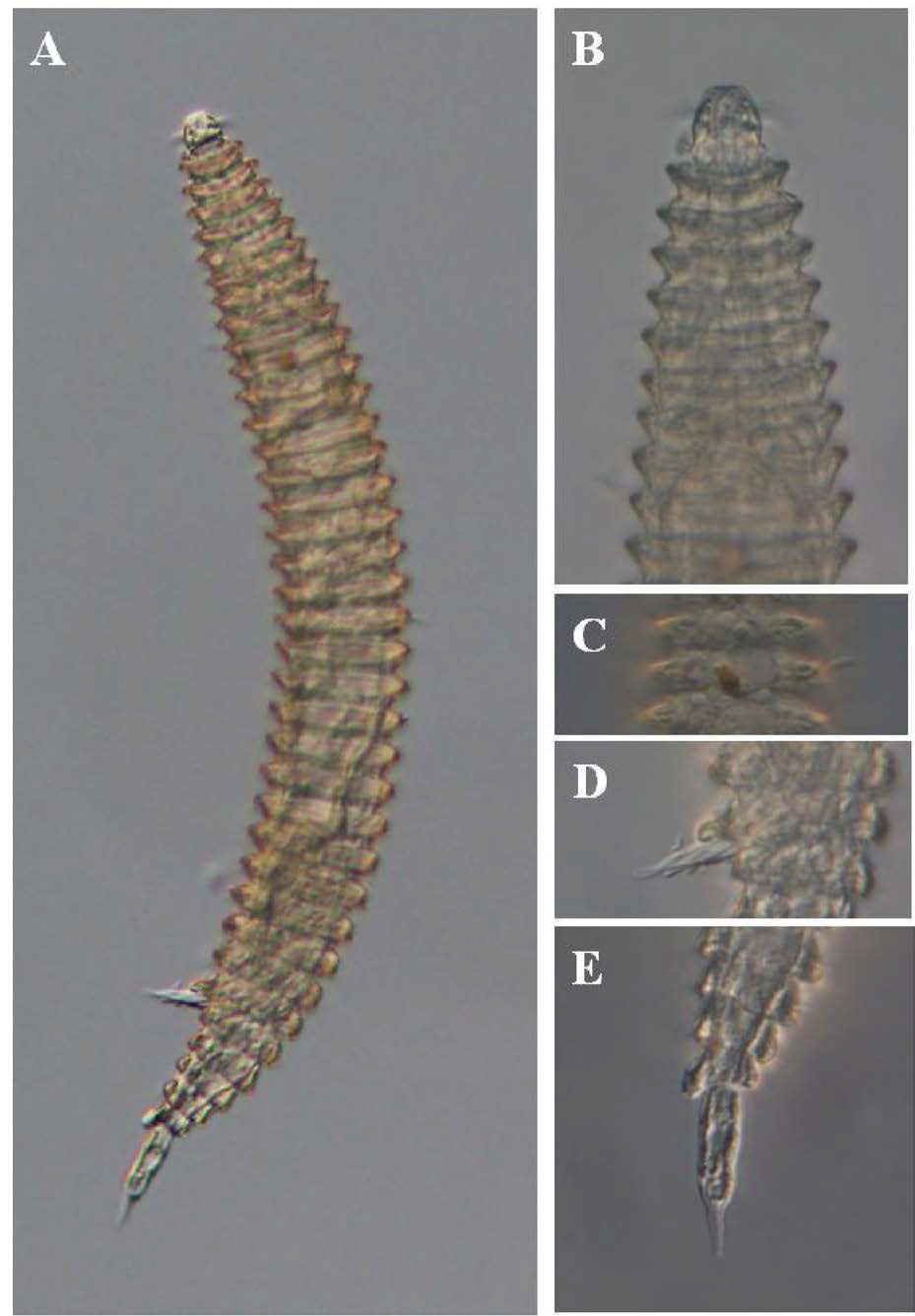Quadricoma n. sp. 3, DIC photomicrographs, male, lateral view