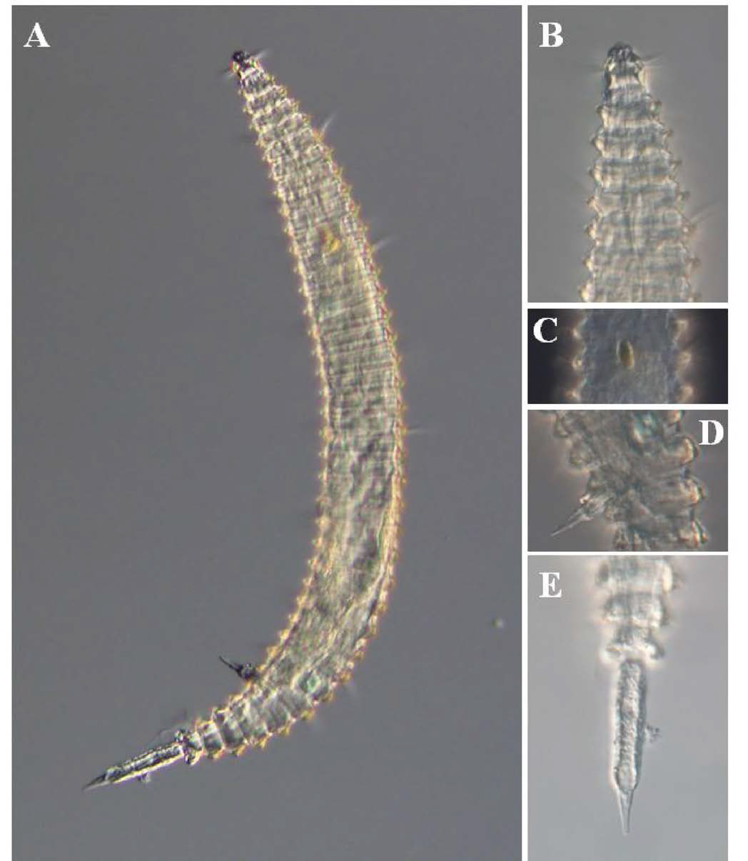 Quadricoma n. sp. 4, DIC photomicrographs, male, lateral view