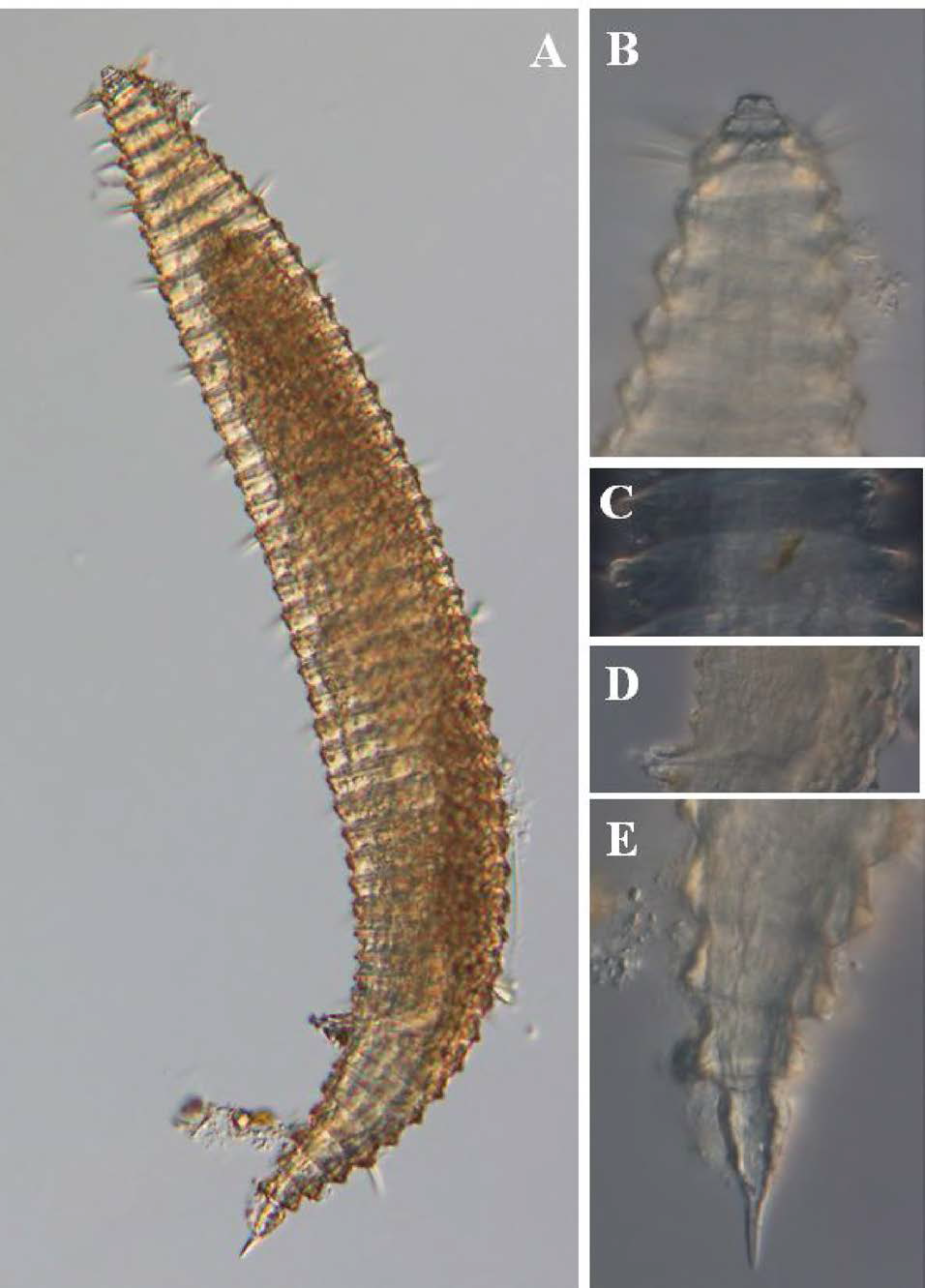 Quadricoma n. sp. 6, DIC photomicrographs, male, lateral view