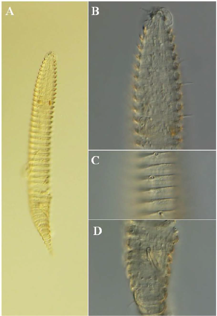 Quadricoma n. sp. 7, DIC photomicrographs, male, lateral view