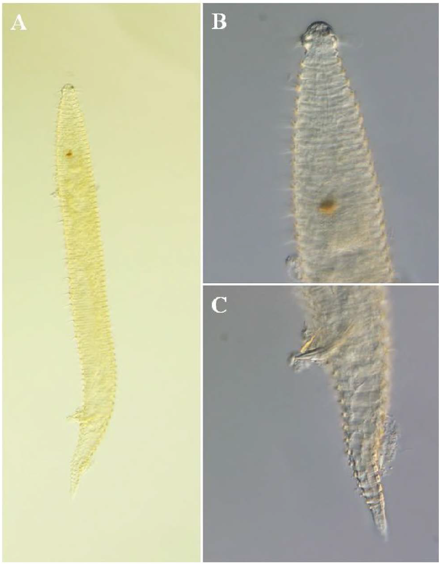 Quadricoma n. sp. 8, DIC photomicrographs, male, lateral view