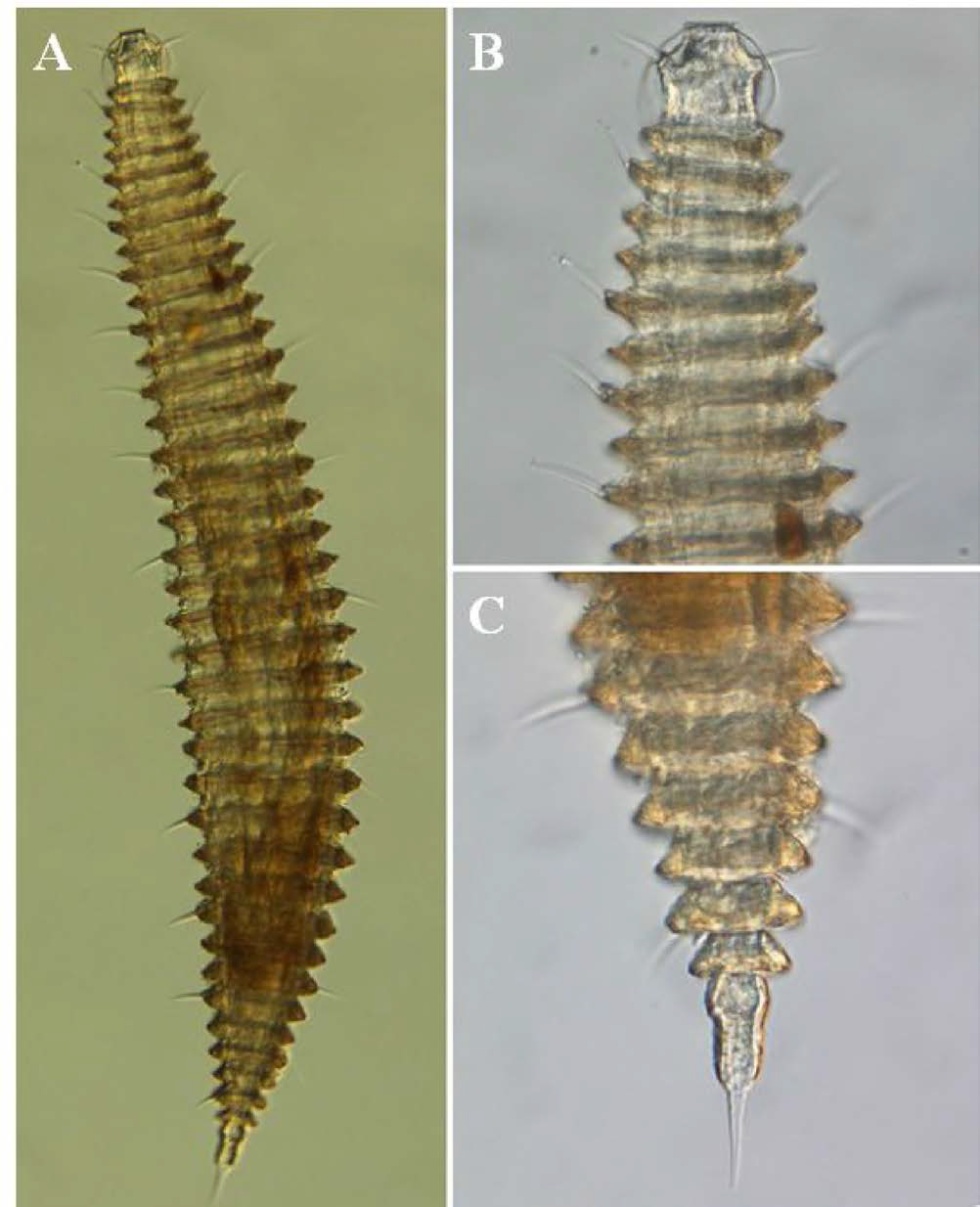 Quadricoma n. sp. 9, DIC photomicrographs, female, lateral view