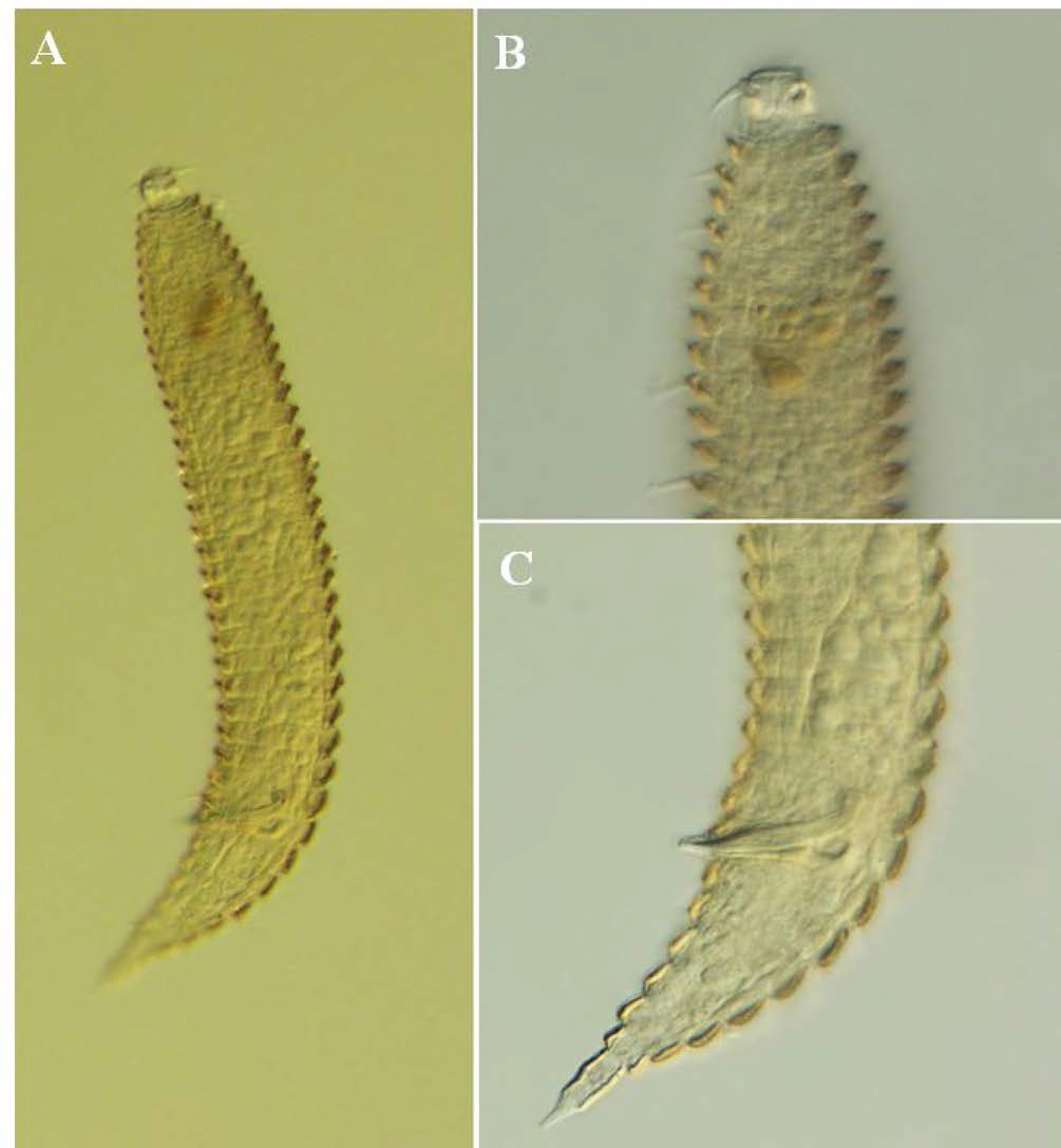 Quadricoma n. sp. 10, DIC photomicrographs, male, lateral view