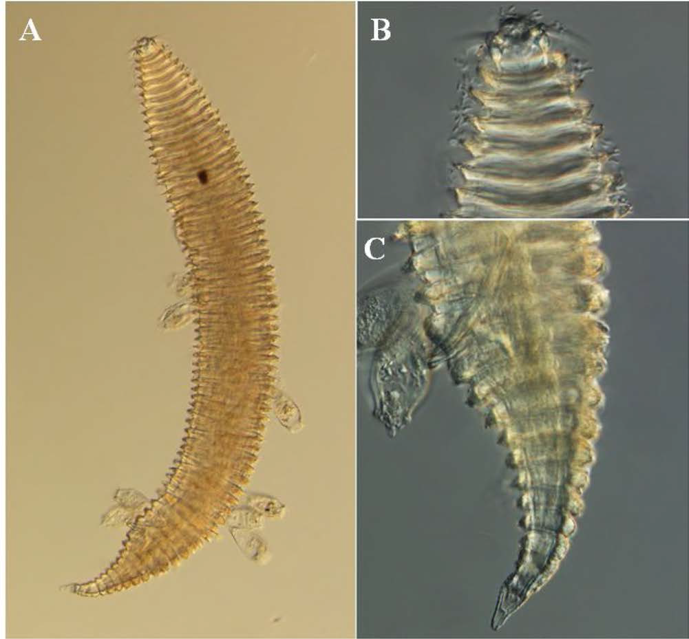 Quadricoma n. sp. 11, DIC photomicrographs, male, lateral view