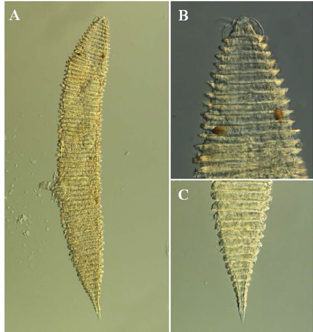 Quakricoma n. sp. 12, DIC photomicrographs, female, lateral view