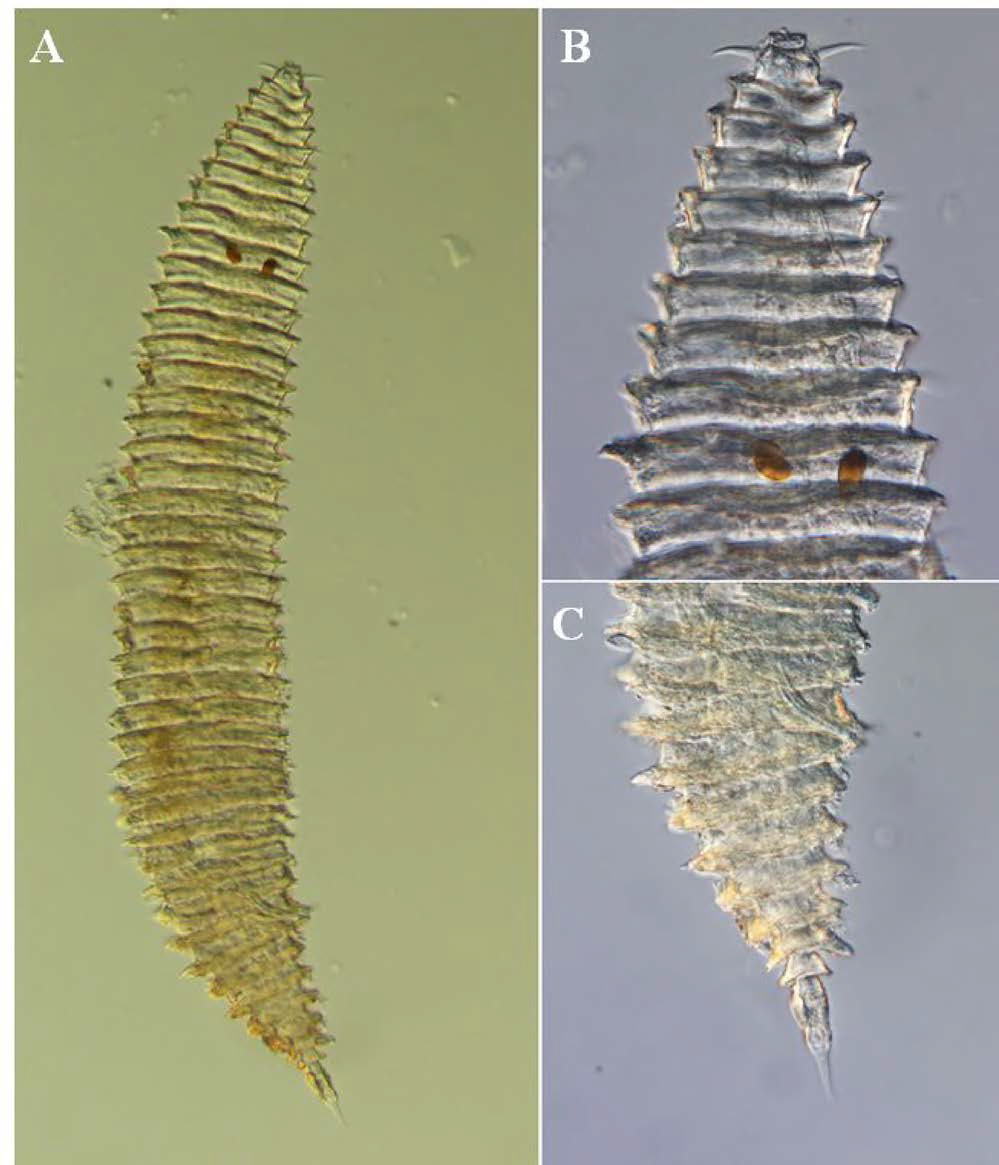 Quadricoma n. sp. 13, DIC photomicrographs, male, lateral view