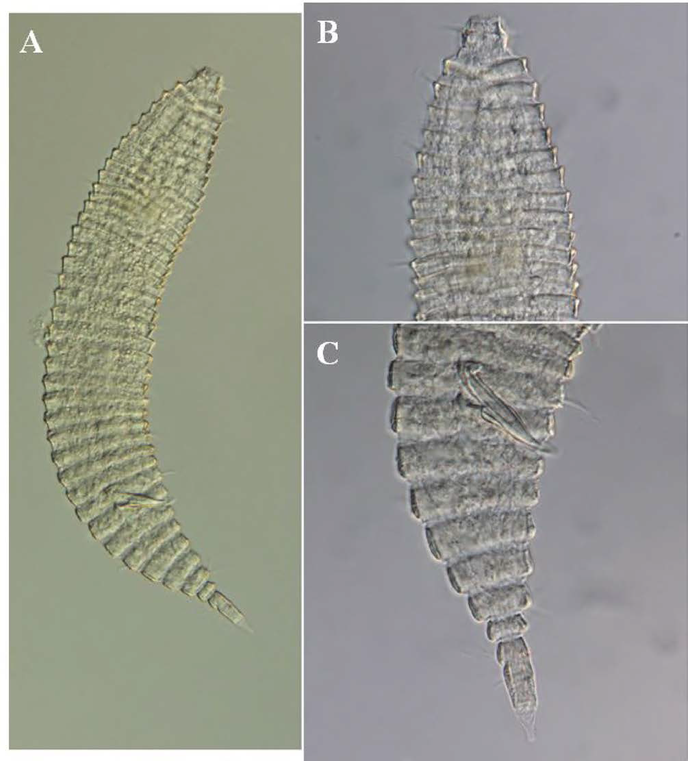 Quadricoma n. sp. 15, DIC photomicrographs, male, lateral view