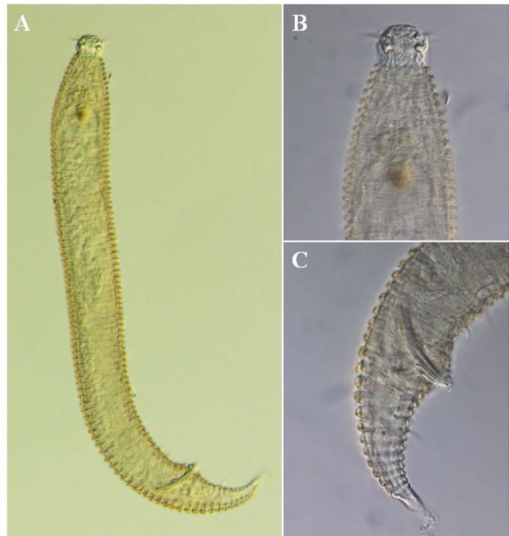 Quadricoma n. sp. 16, DIC photomicrographs, male, lateral view