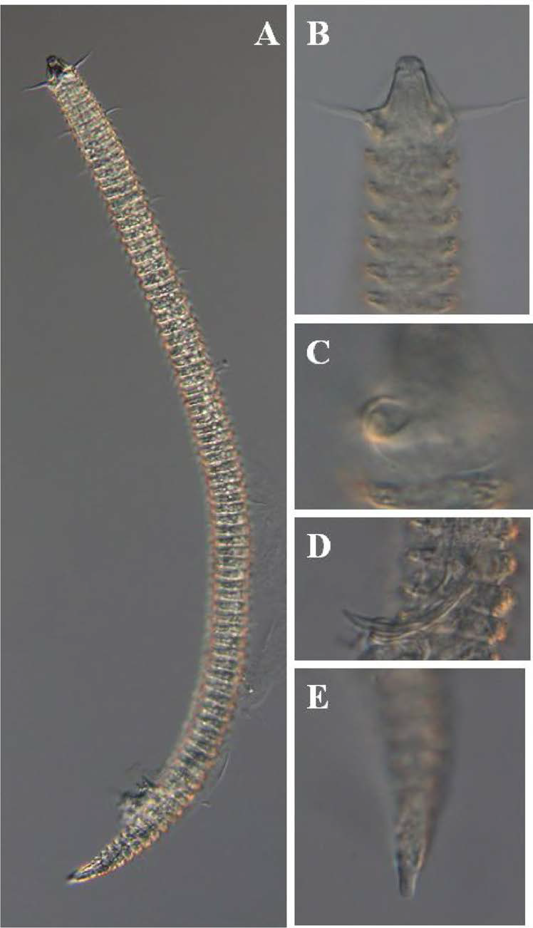 Tricoma n. sp. 1, DIC photomicrographs, male, lateral view