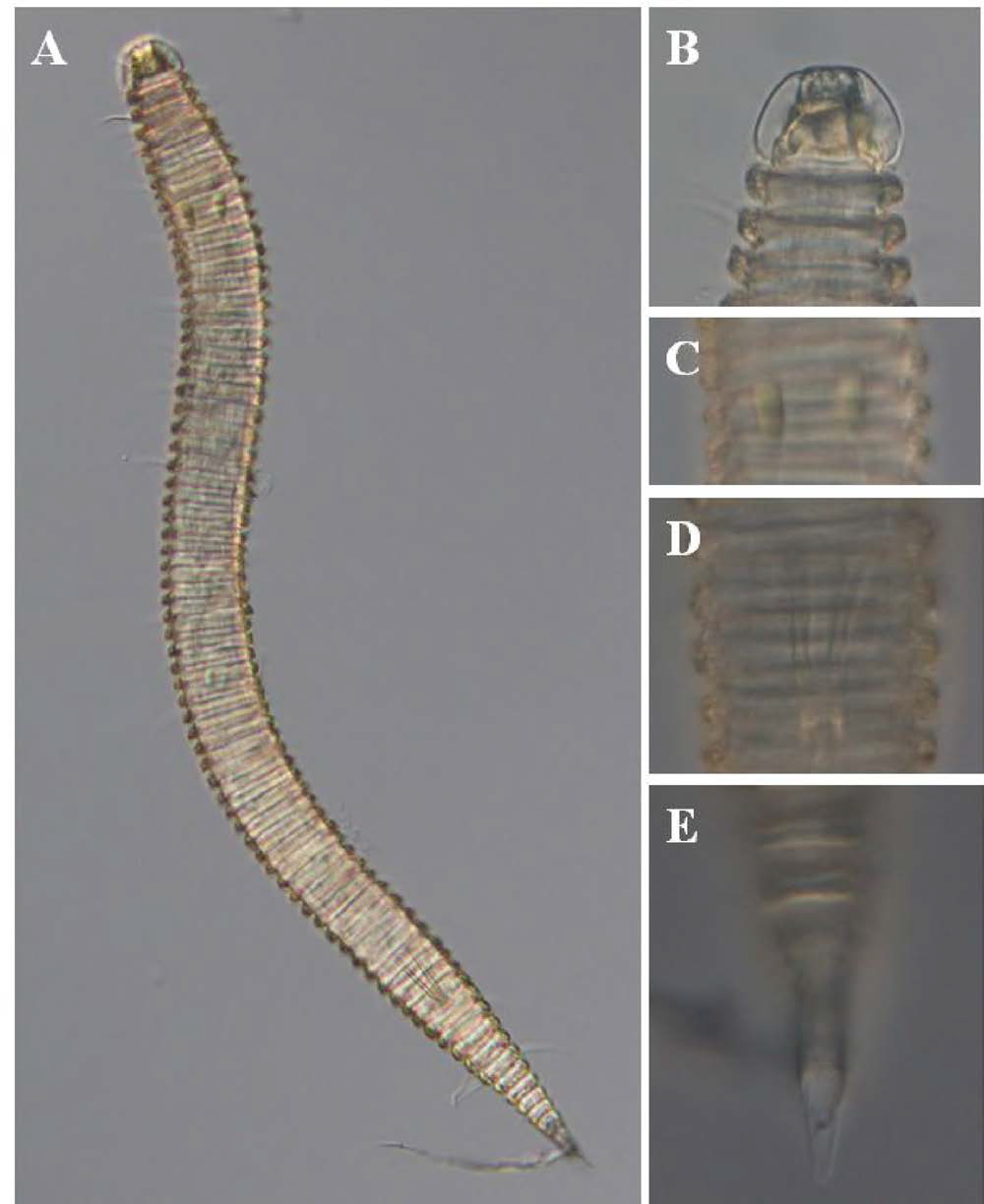 Tricoma n. sp. 2, DIC photomicrographs, male, ventral view