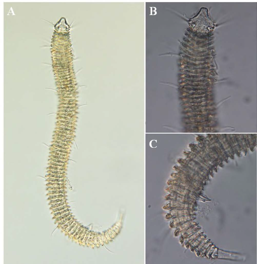 Tricoma n. sp. 4, DIC photomicrographs, male, lateral view