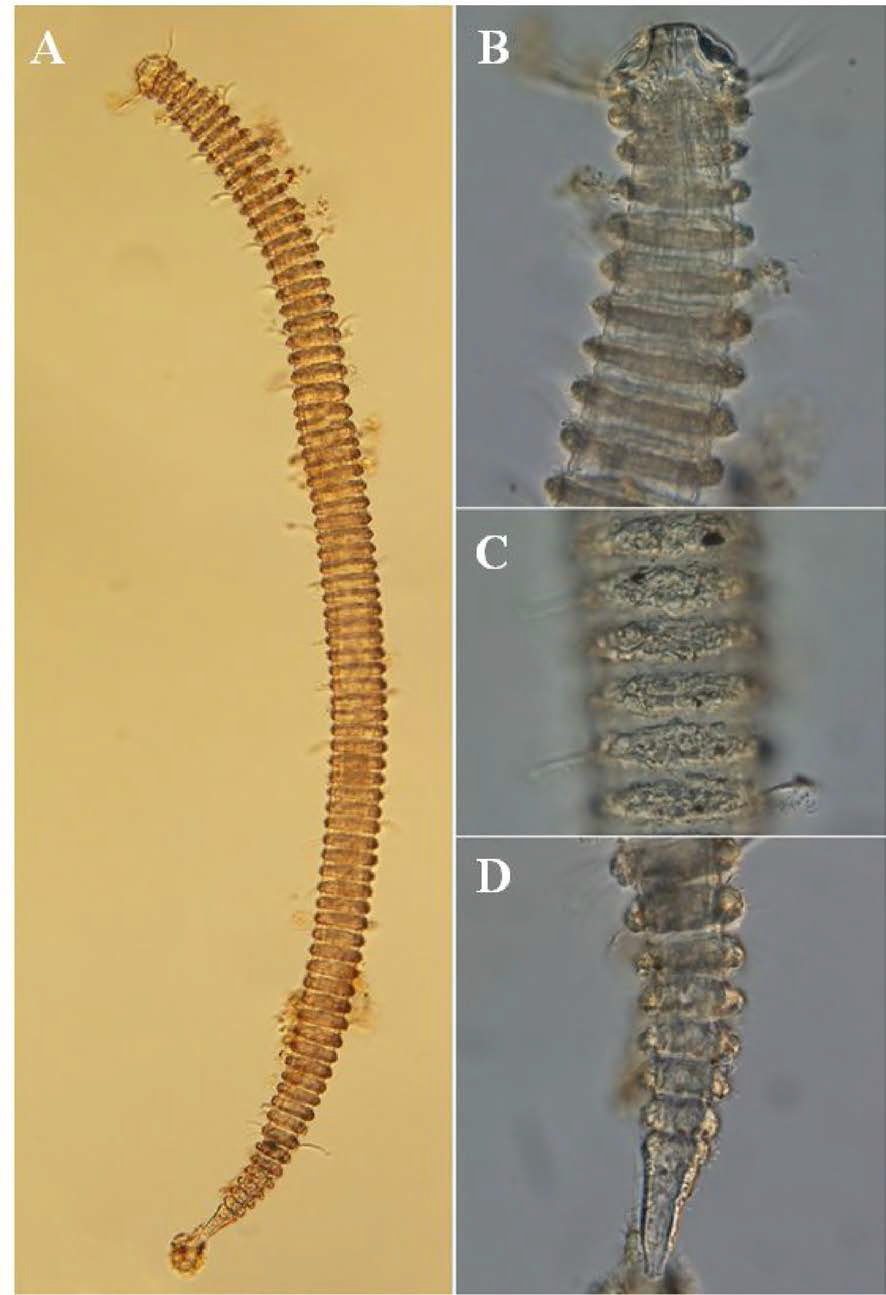 Tricoma n. sp. 5, DIC photomicrographs, female, lateral view