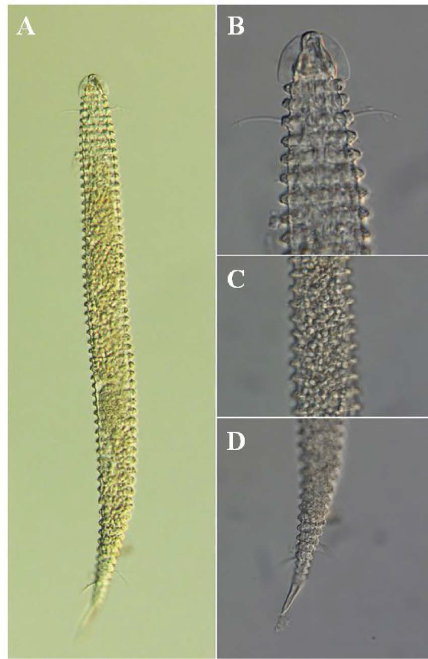 Tricoma n. sp. 6, DIC photomicrographs, female, lateral view