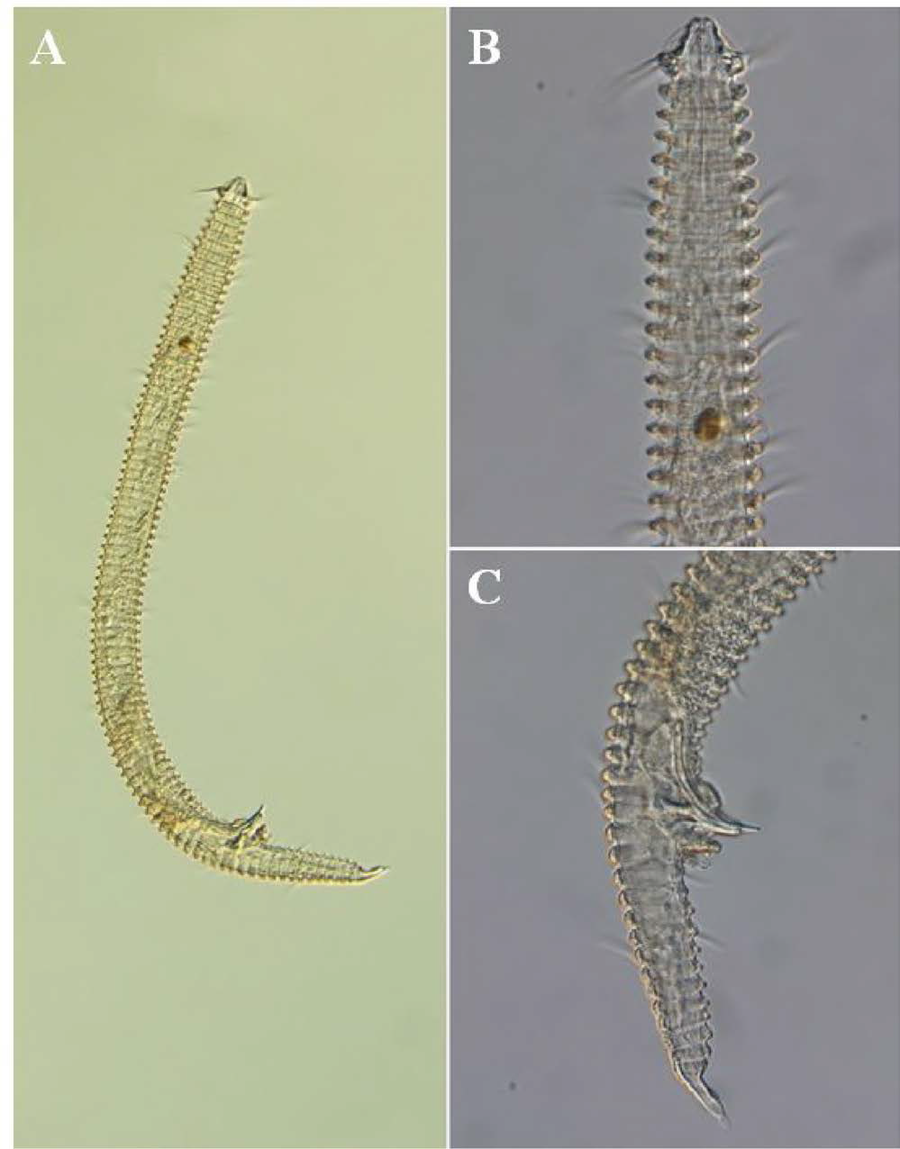 Tricoma n. sp. 7, DIC photomicrographs, male, lateral view