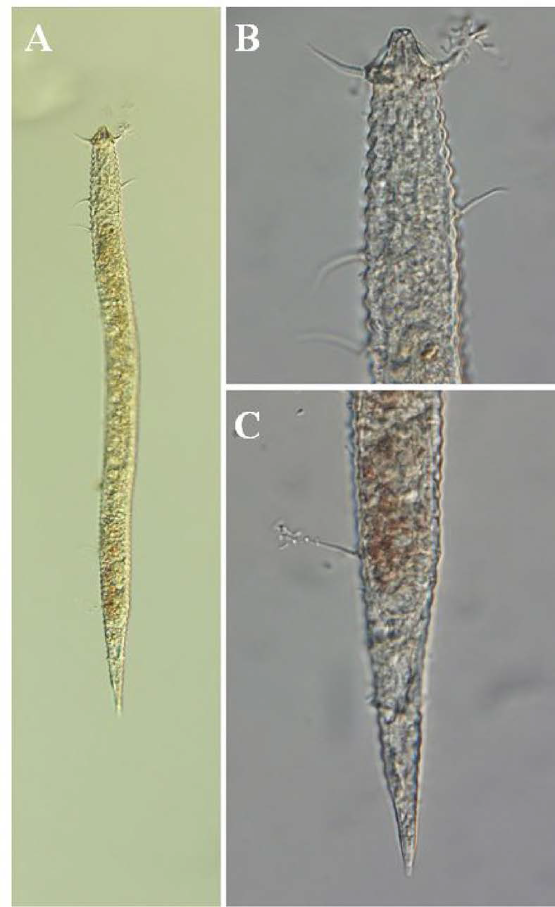 Tricoma n. sp. 8, DIC photomicrographs, female, lateral view