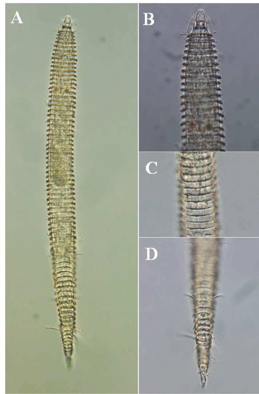 Tricoma n. sp. 9, DIC photomicrographs, female, lateral view