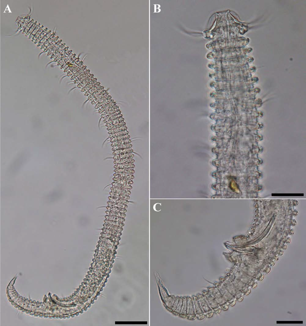 Tricoma n. sp. 10, DIC photomicrographs, male, lateral view
