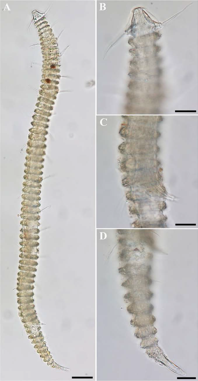 Tricoma n. sp. 10, DIC photomicrographs, male, lateral view