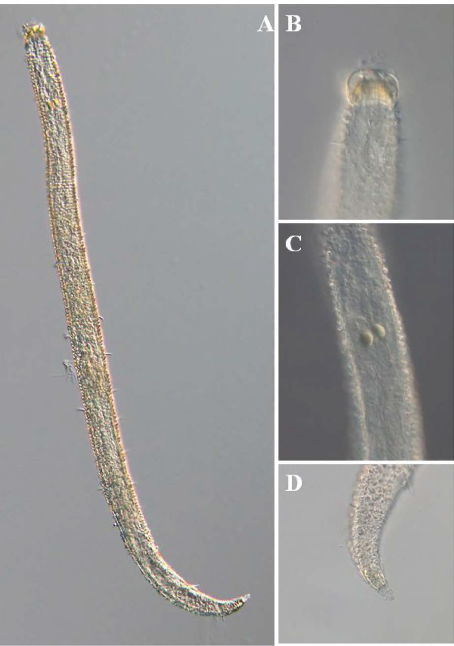 Paratricoma n. sp., DIC photomicrographs, female, lateral view