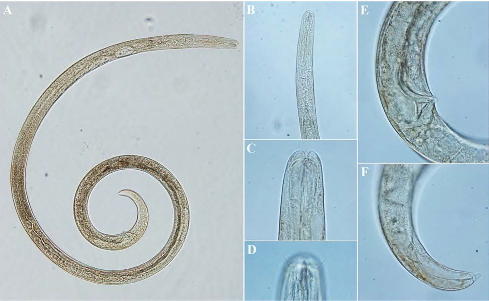 Metalinhomoeus gracilis, DIC photomicrographs, male, lateral view