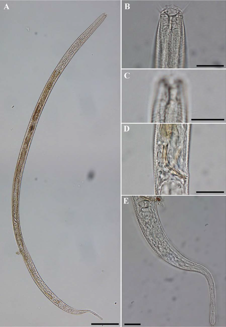 Daptonema calceolatum, DIC photomicrographs, male, lateral view