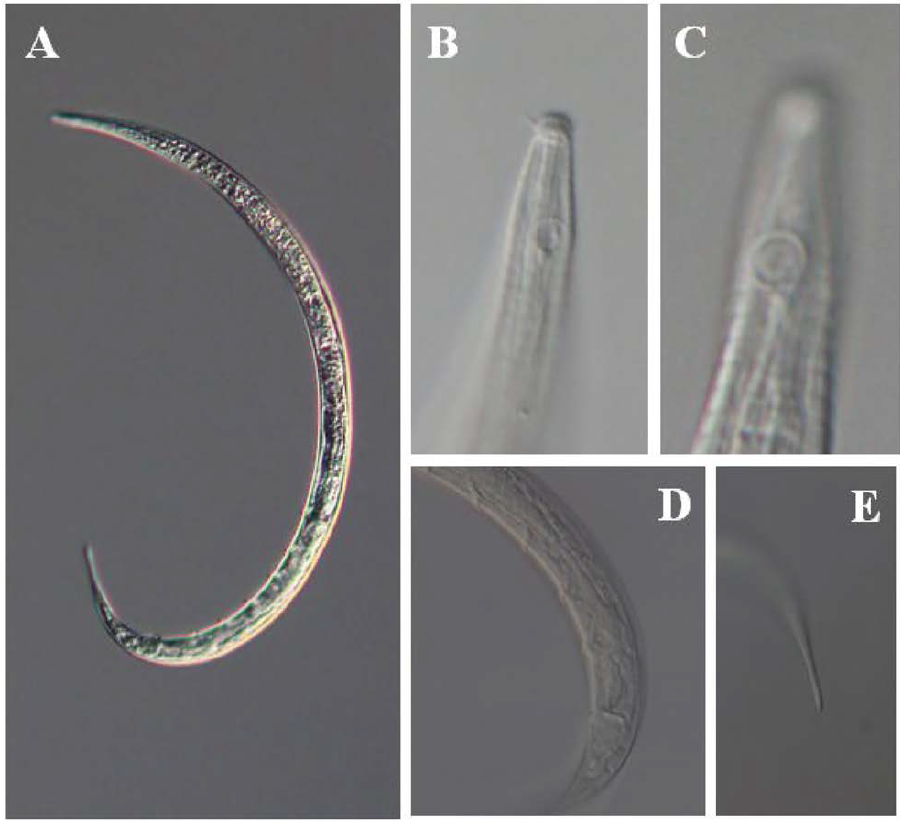 Manganonema n. sp., DIC photomicrographs, male, lateral view