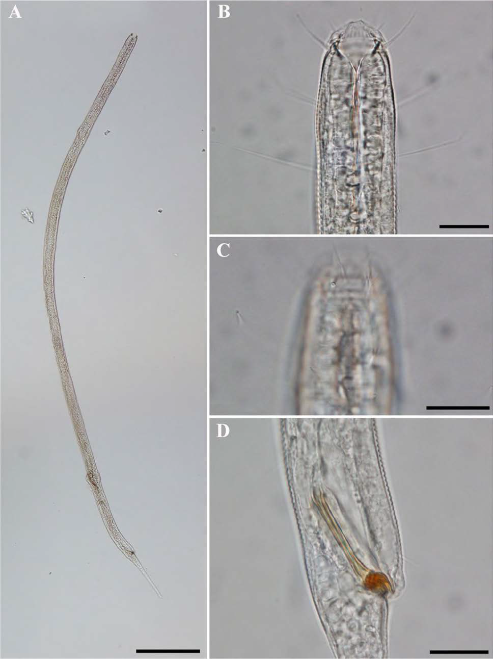 Metadesmolaimus n. sp., DIC photomicrographs, male, lateral view