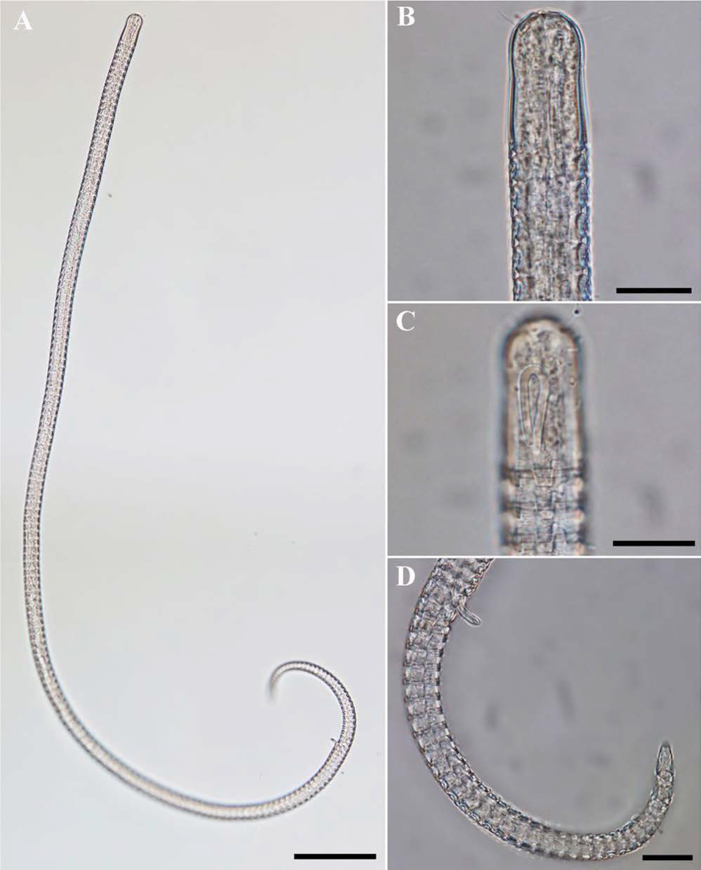 Ceramonema inguinispina, DIC photomicrographs, male, lateral view