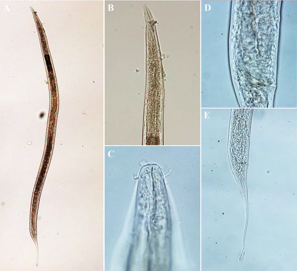 Anticoma acuminata, DIC photomicrographs, male, lateral view