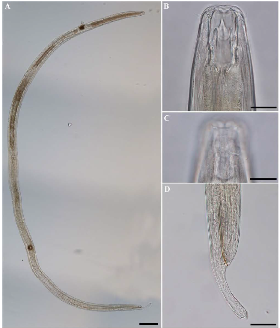 Adoncholaimus crassicaudus, DIC photomicrographs, male, lateral view