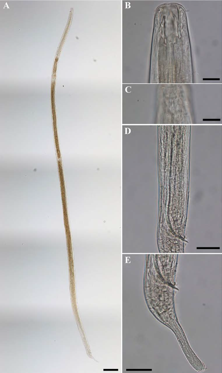 Metoncholaimus n. sp., DIC photomicrographs, male, lateral view