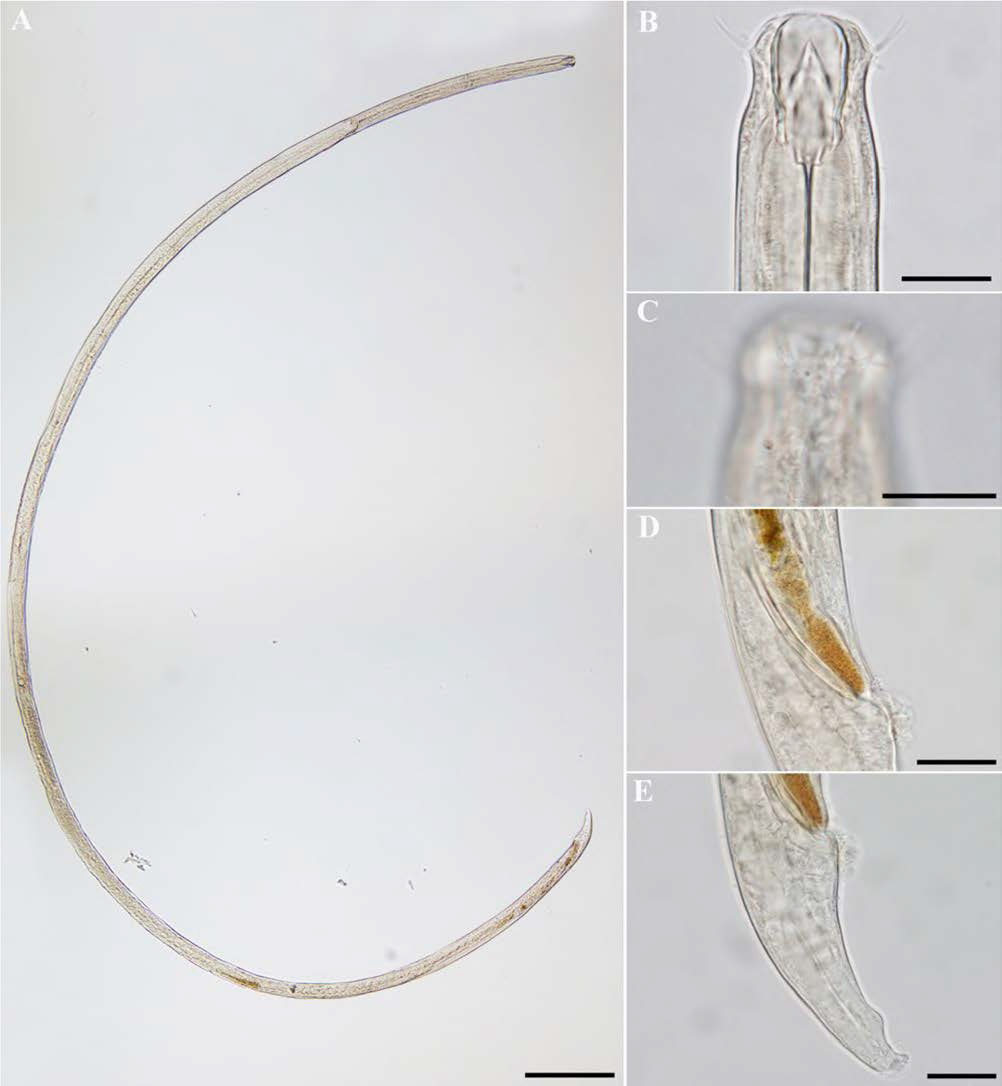 Oncholaimus qingdaoensis, DIC photomicrographs, male, lateral view