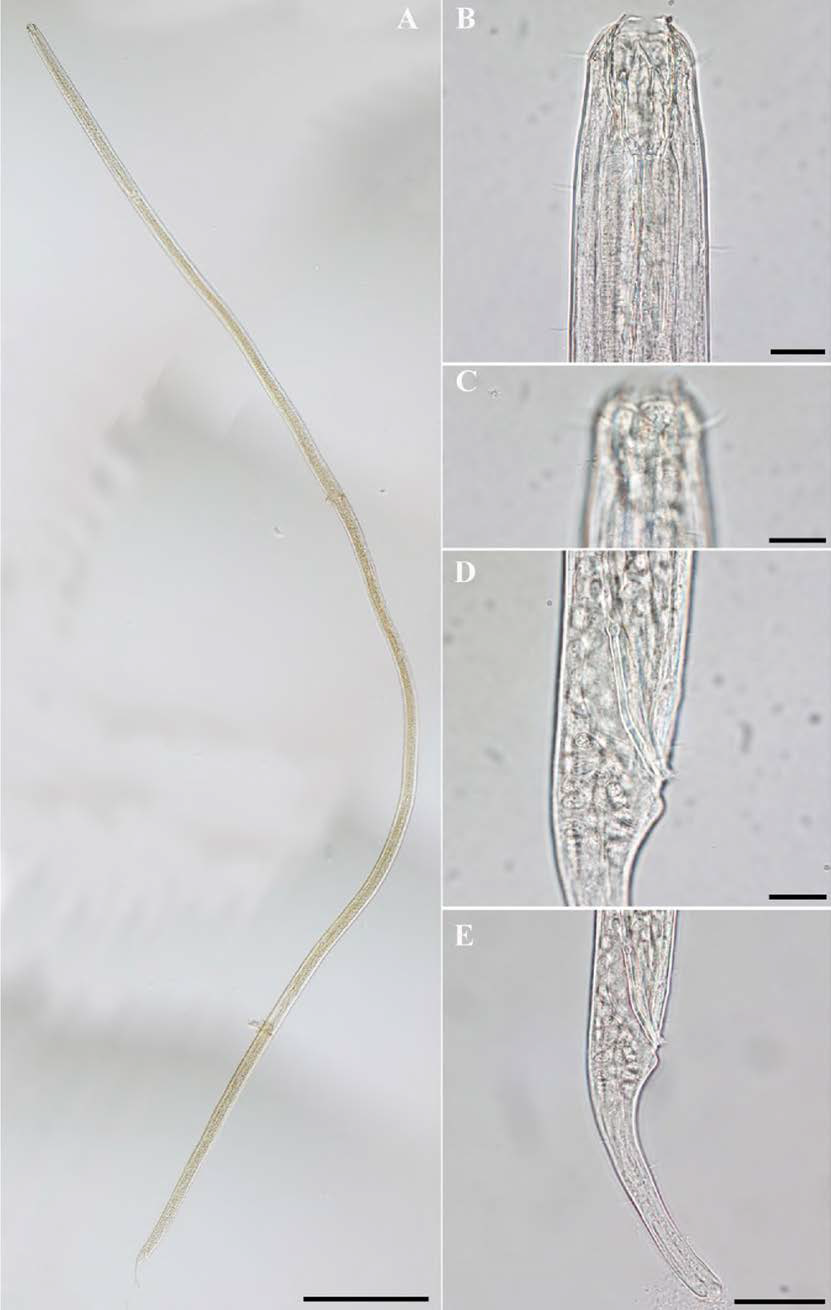 Oncholaimus scanicus, DIC photomicrographs, male, lateral view