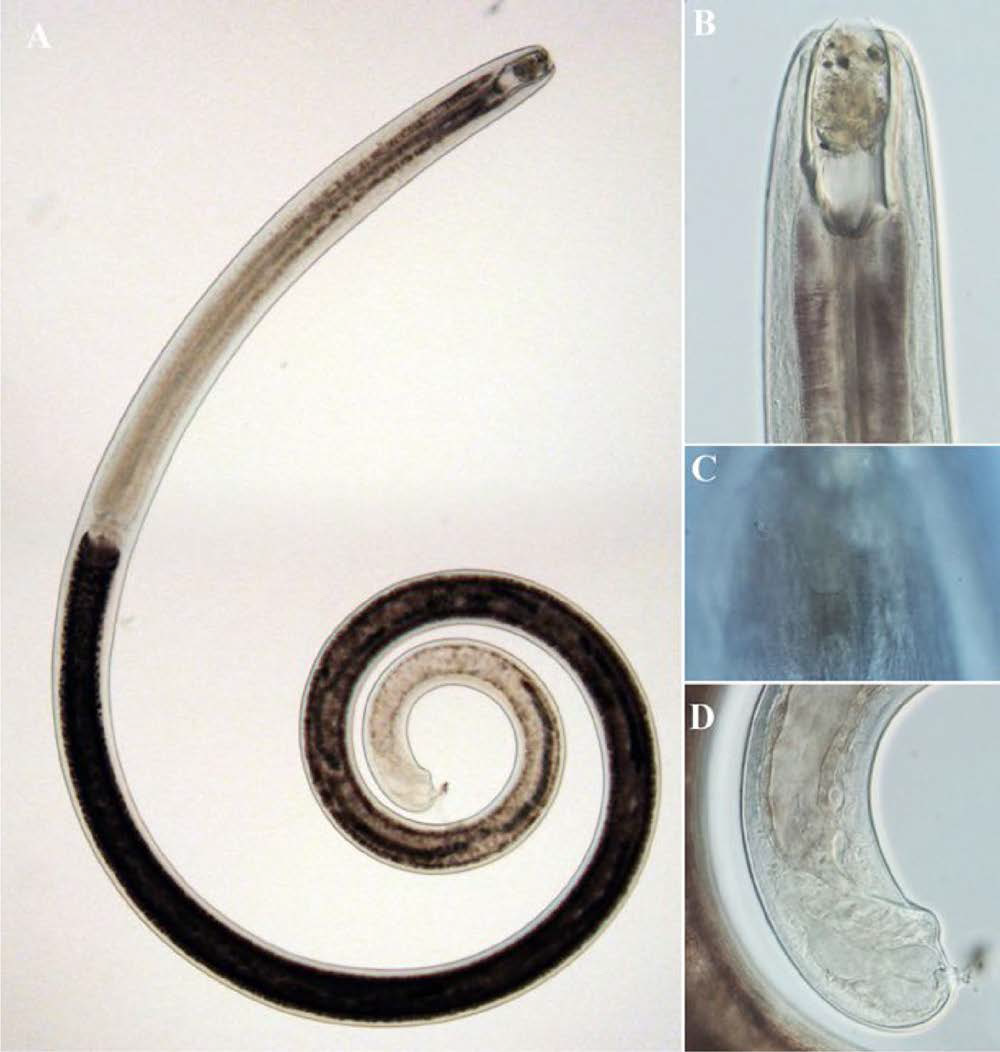 Pontonema papilliferum, DIC photomicrographs, female, lateral view