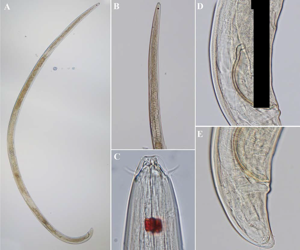 Metaphanoderma kamtchaticum, DIC photomicrographs, male, lateral view