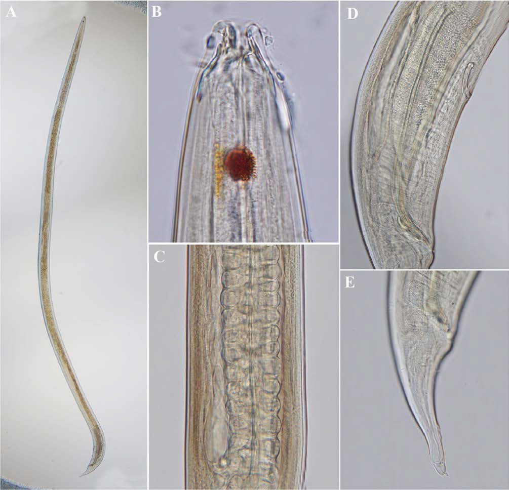 Phanoderma ocellatum, DIC photomicrographs, male, lateral view