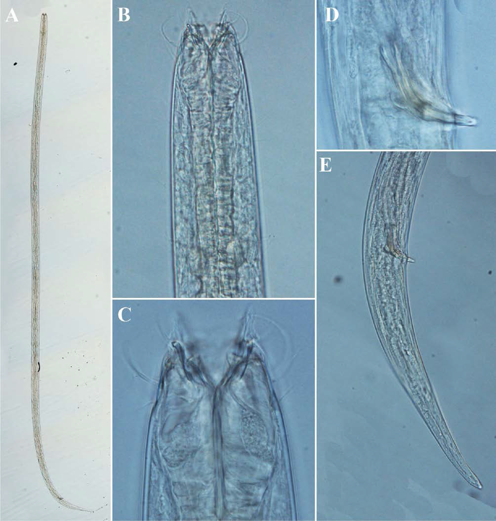 Enoplolaimus balgertsis, DIC photomicrographs, male, lateral view