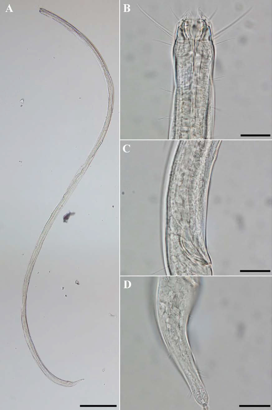 Enoplolaimus lenunculus, DIC photomicrographs, male, lateral view