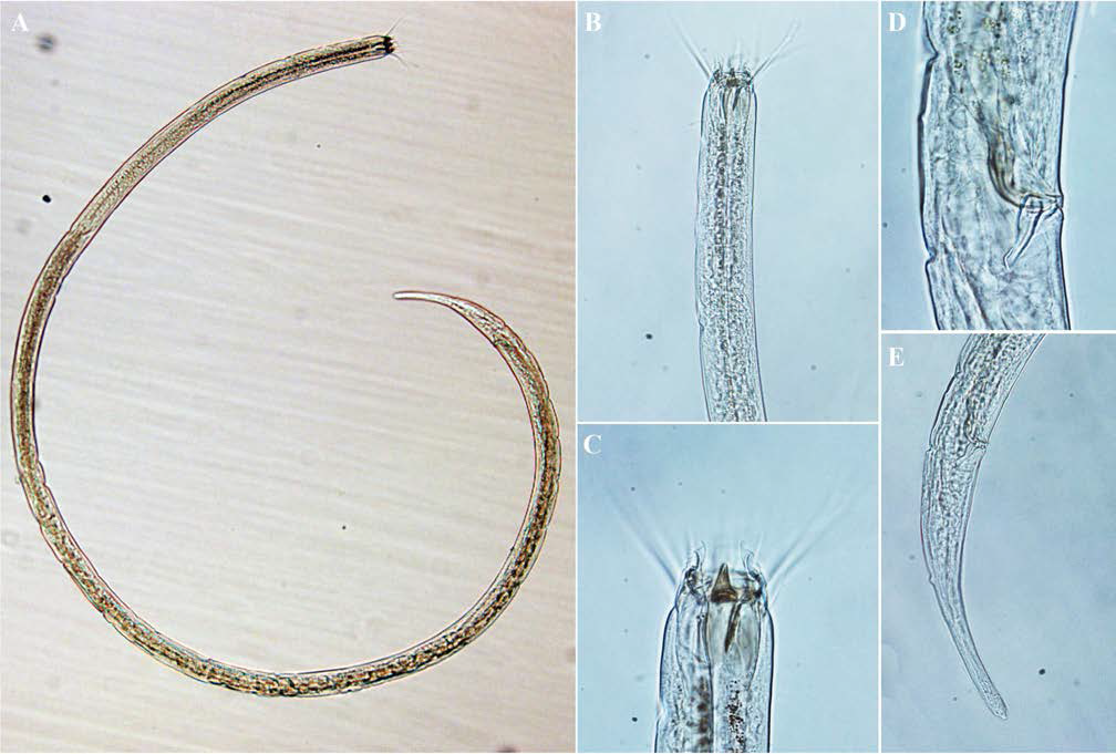 Enoplolaimus litoralis, DIC photomicrographs, male, lateral view