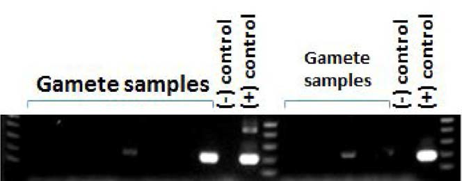 PCR detection of transgene in the gametes obtained from presumed founder transgenic fish individuals