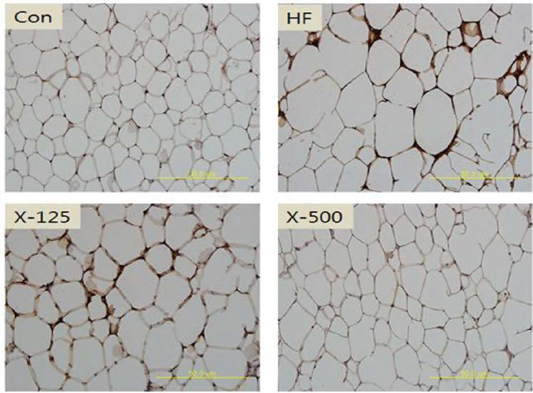 IHC results fed GA extracts treatments compared to HF: High fat diet (HF), HF+ X 물질